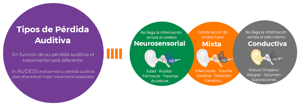 Tipos de Pérdida Auditiva